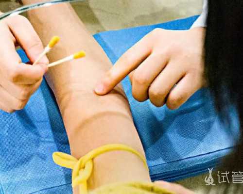 国内供卵一般要等好久,找供捐卵子的地方有哪里,哪里会有正规捐卵子