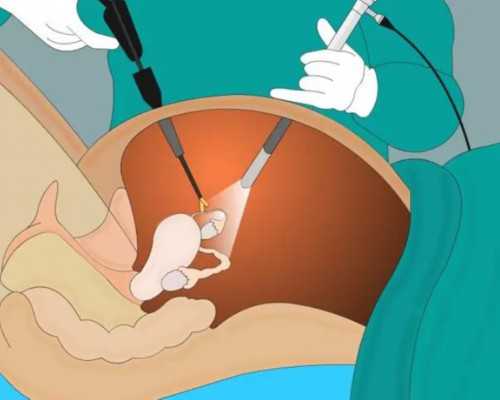 国内代生哪里好,辐射对男性*育力的影响，为什么做试管婴儿要远离辐射