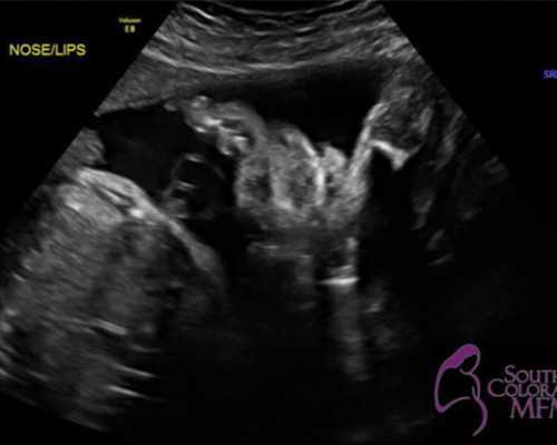 中国哪里有供卵机构最多,高龄*育有什么危害？高龄打胎危害大吗